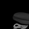 SPORK, NICO - 22.03.1976 - 02.08.2022 - CT obere Extremität - 17:59:38